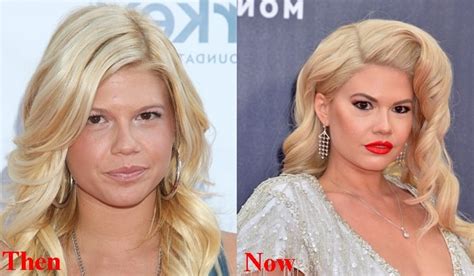 chanel west coast before surgery|chanel west coast gender change.